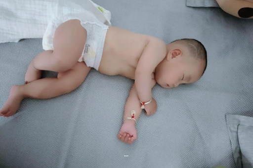 正定宝宝突然很多眼屎